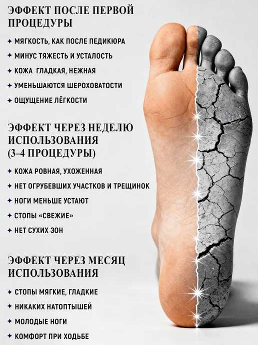 ELIXIRÉ DE MAGIE Соль для ванны для ног и тела с мочевиной, вариант, фото 8
