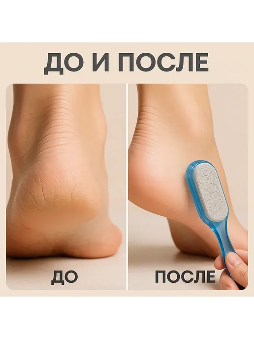 Щетка для ног с пемзой для ухода и очищения, синий, фото 2