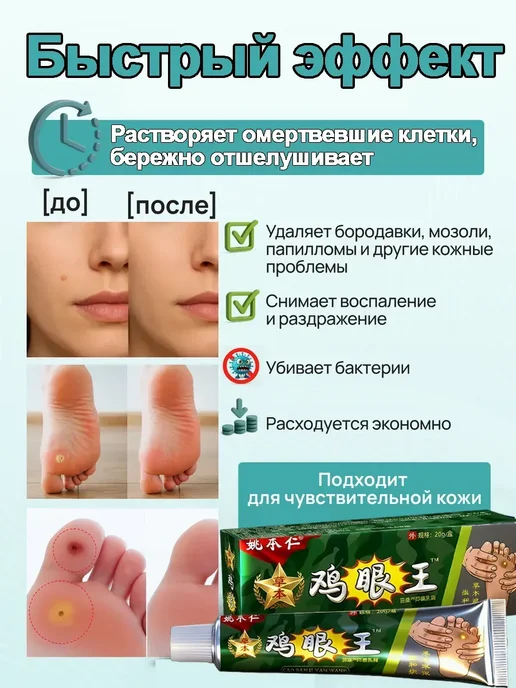 Крем от натоптышей на ногах, 20 мл, фото 4