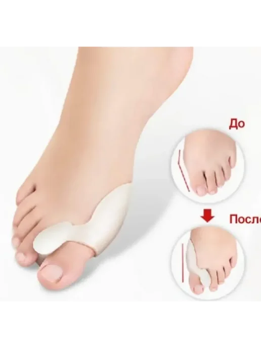 Фиксатор (Valgus Pro) от выступающей косточки на ногах, белый