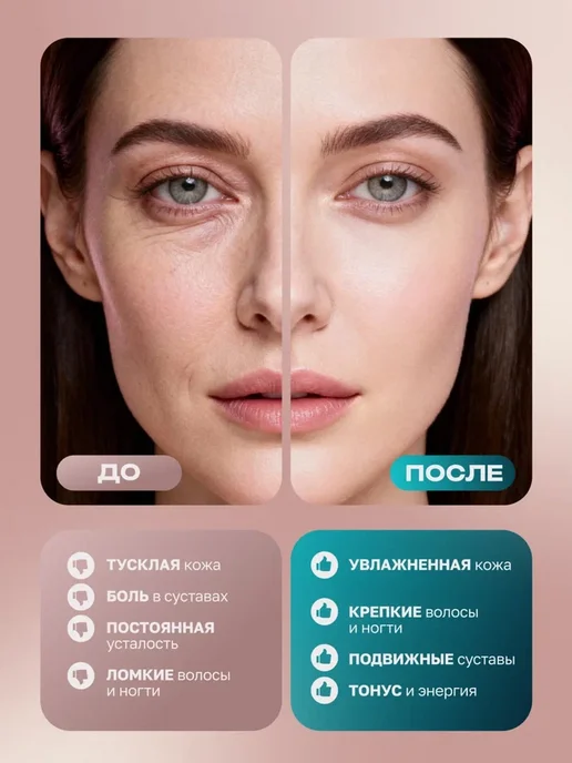 COLLA GEN (Первый живой коллаген) Живой коллаген продукт для суставов и связок, вариант, фото 3