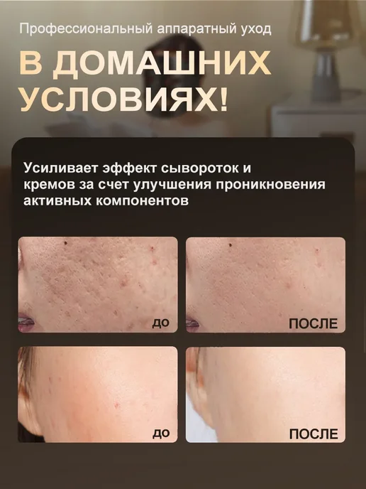 SHEIVULO LED маска для лица светодиодная, 7 цветов, фототерапия, 7 цв., фото 8