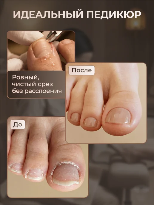 TIRNAK Кусачки для вросшего ногтя педикюрные NNL06L2 16, серый, фото 4